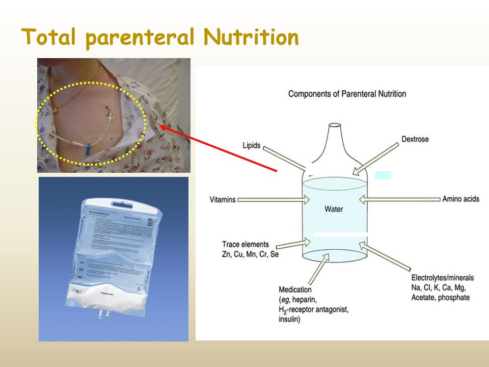 Parenteral Nutrition | Definition & Patient Education